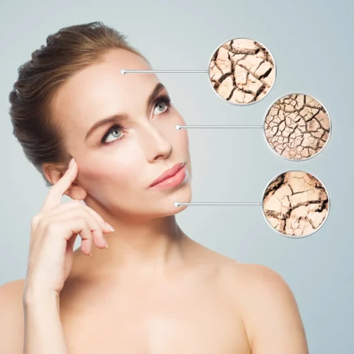 woman thinking about what effects her aged looking skin, with photos of cracked skin zoomed in